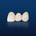 Customized Dental Porcelain Fused To Metal